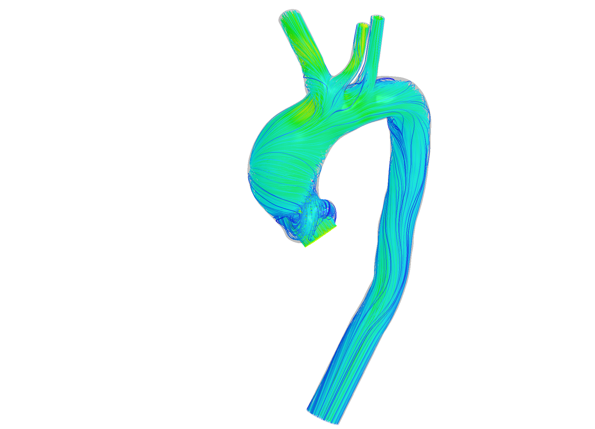 aorta